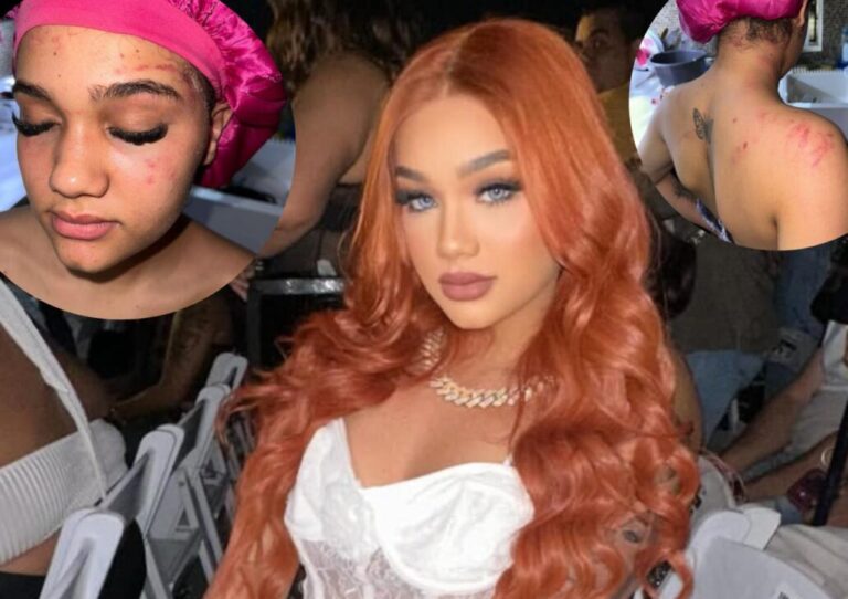 ¡Alarmante! Masha denuncia a Dilon Baby por intento de asesinato